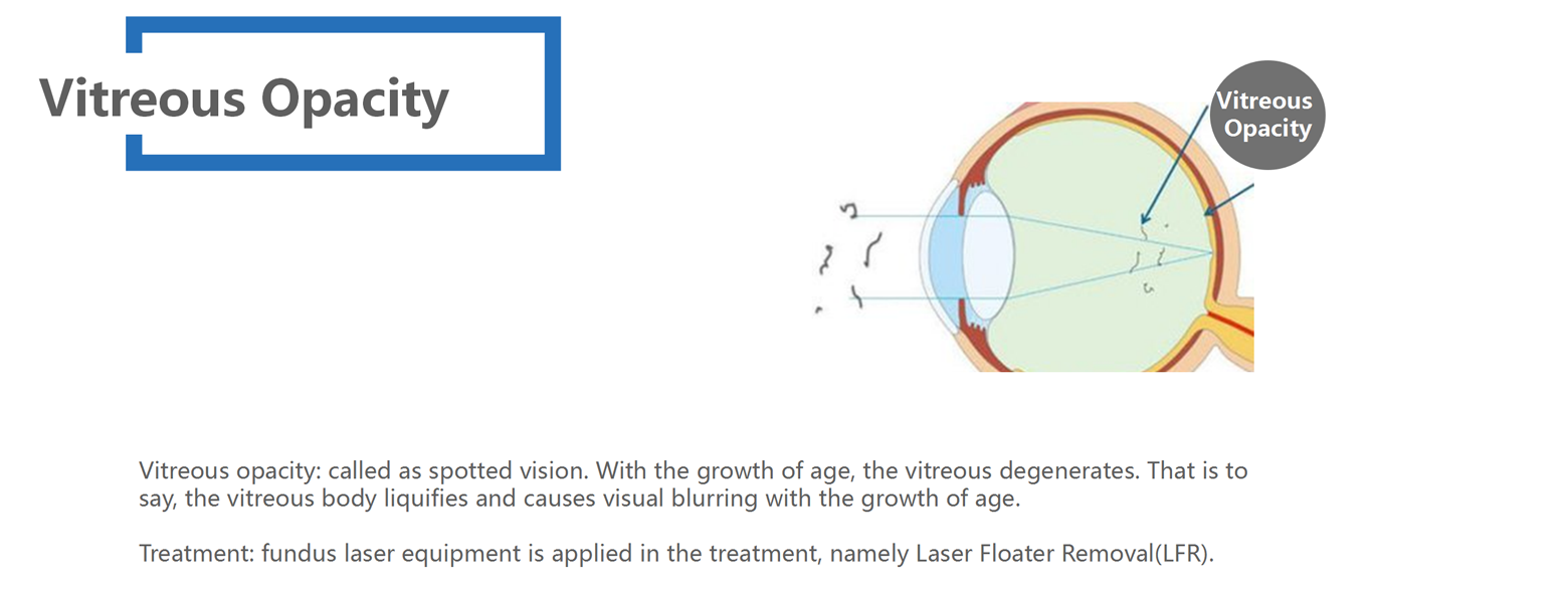 Fundus Disease_02