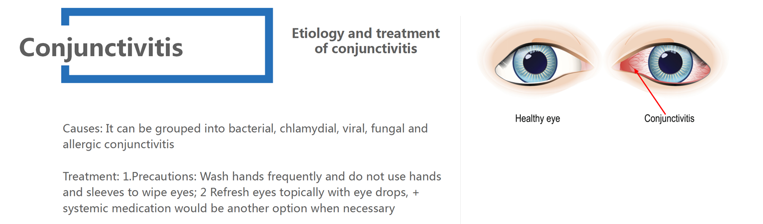 Corneal Disease_03