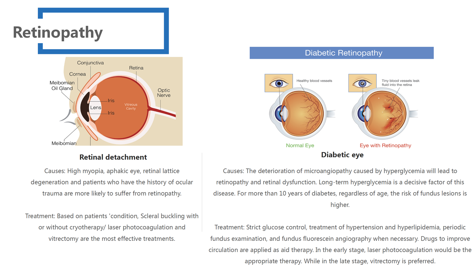 Fundus Disease_04