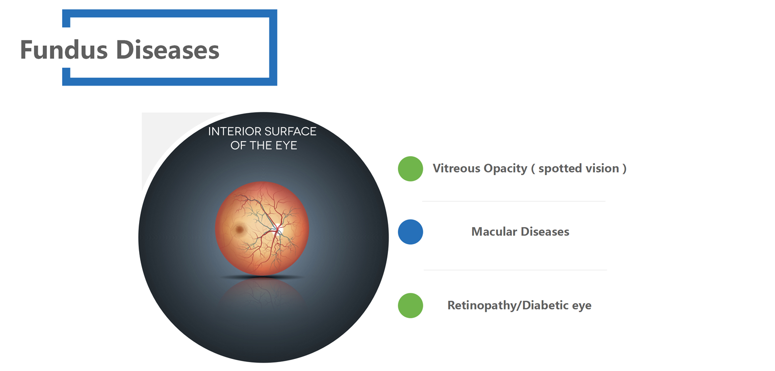 Fundus Disease_01