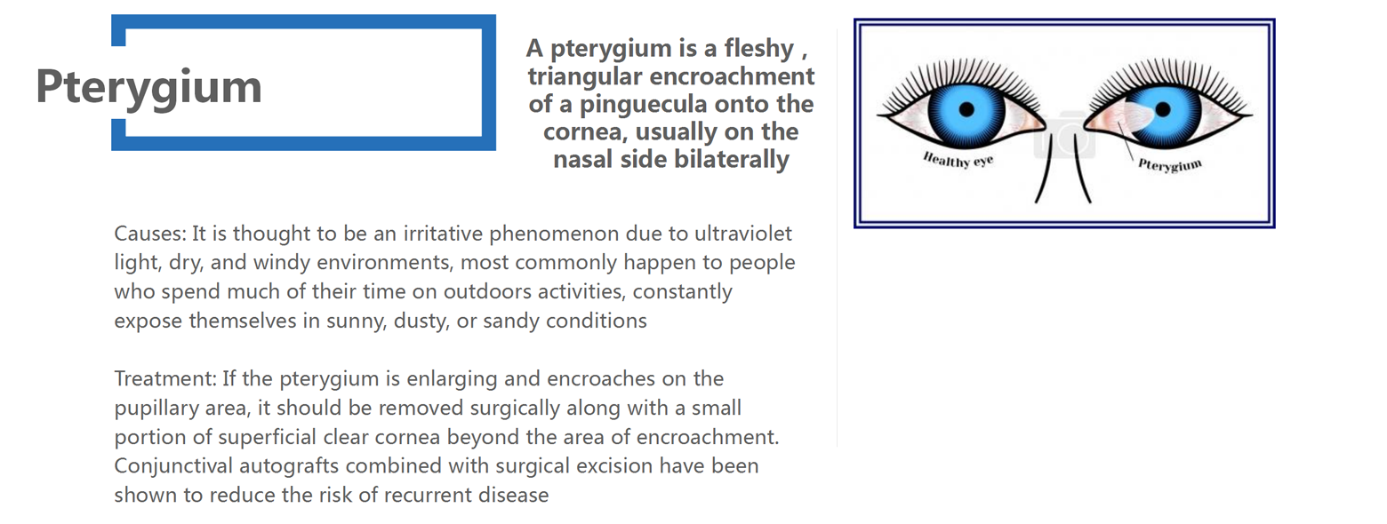 Corneal Disease_06