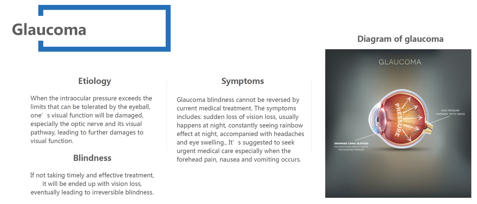 Glaucoma_01