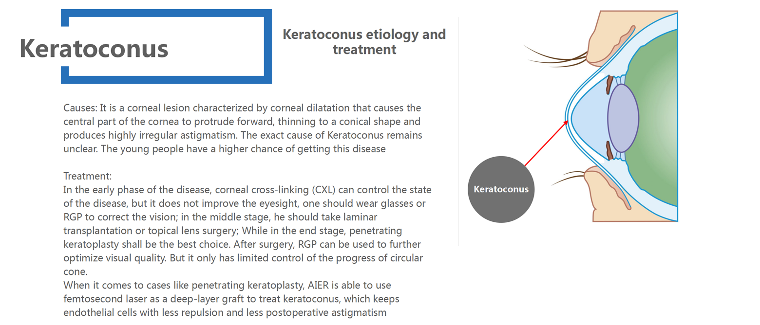 Corneal Disease_05