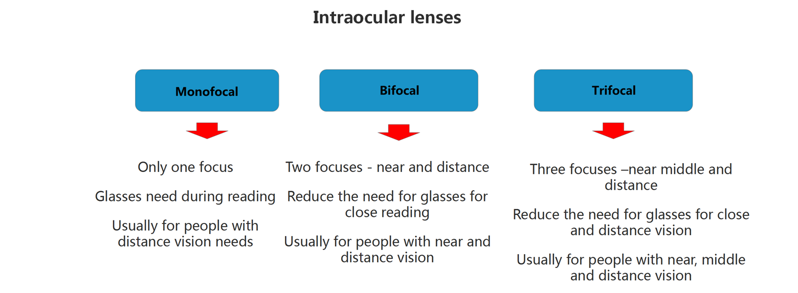 Cataract_04